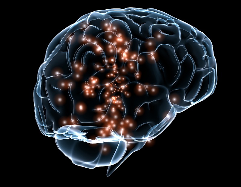 BrainLight - http://upload.wikimedia.org/wikipedia/commons/c/c3/Neuronal_activity_DARPA.jpg